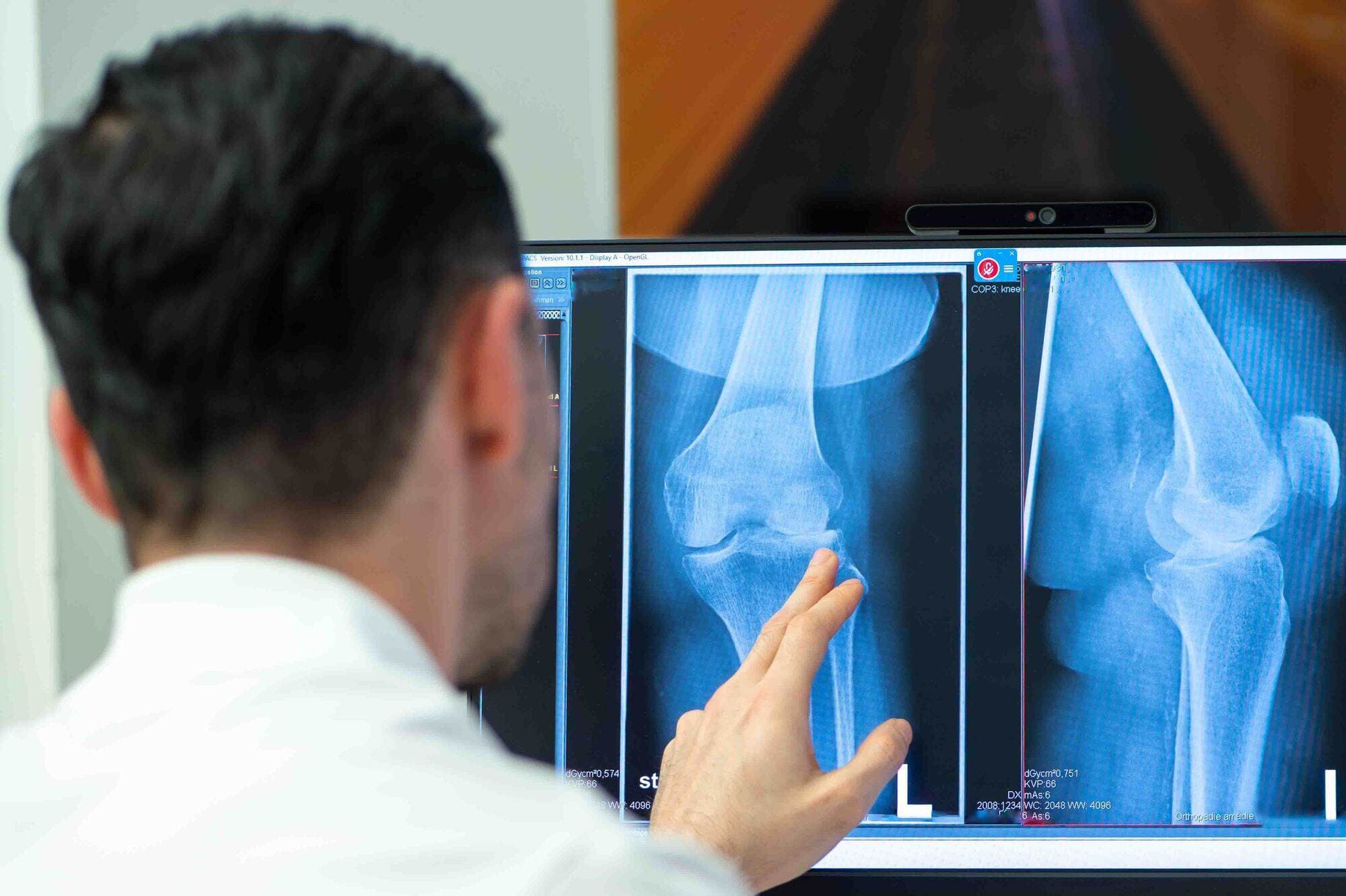 Eingewachsener Zehennagel OP – Spezialisierte Fußchirurgie bei Capital Orthopedics Berlin